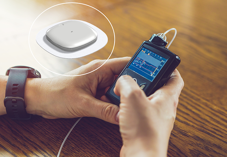 Boucle semi-fermée MiniMed 780G associé au capteur Simplera Sync