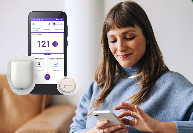 Pompe à insuline patch : Remboursement OMNIPOD 5 et Dexcom G7