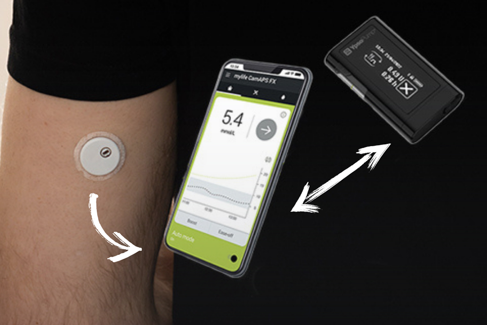 Remboursement de la pompe a insuline en boucle semi-fermee MYLIFE CAMAPS FX avec le Freestyle Libre 3
