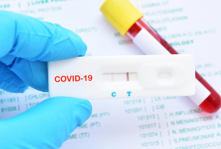 depistage de la covid 19 les tests antigeniques federation francaise des diabetiques