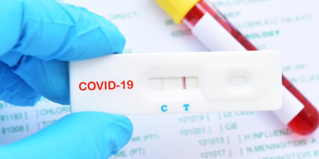 Dépistage de la Covid 19 les tests antigéniques … Fédération
