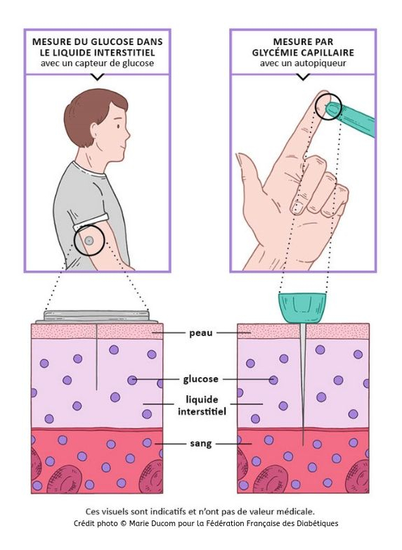 Comment bien utiliser son lecteur de glycémie ?